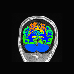 Figure 28