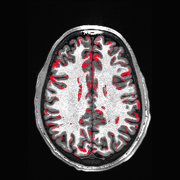 Figure 30