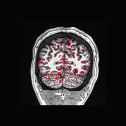Figure 31
