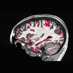 Figure 32