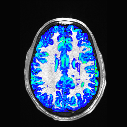 Figure 33