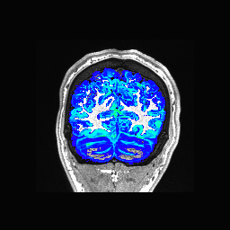 Figure 34