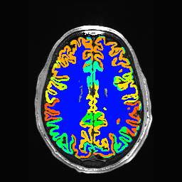 Figure 36