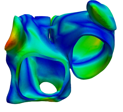 Figure 11