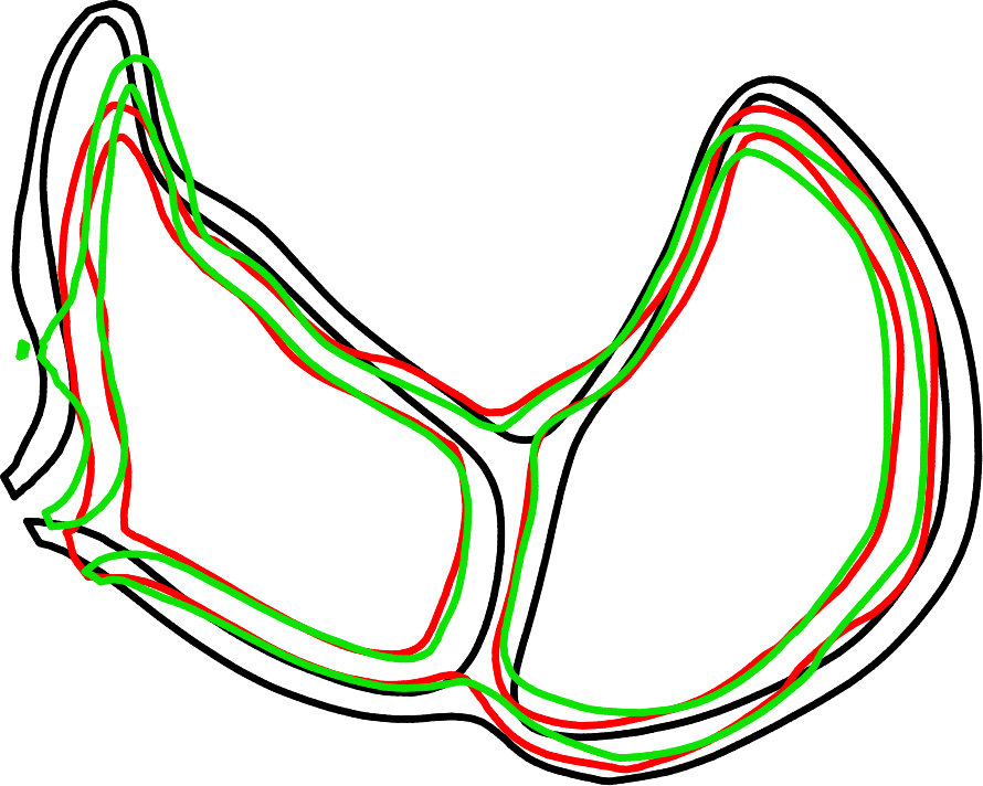 Figure 32