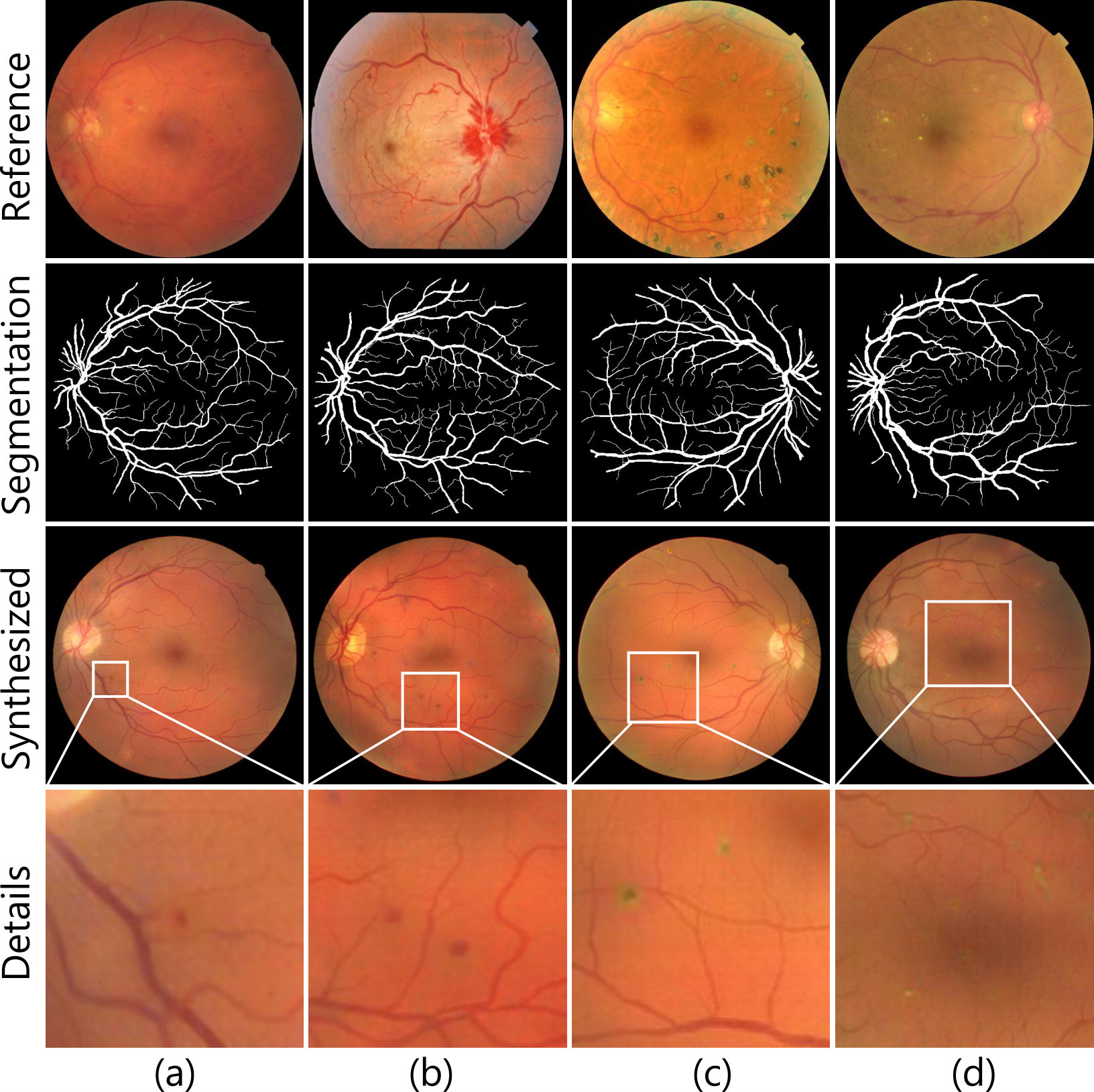 Figure 12