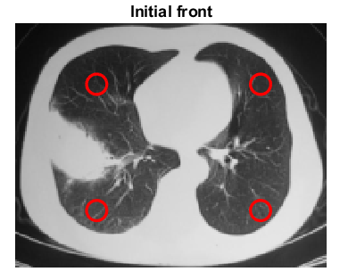 Figure 15