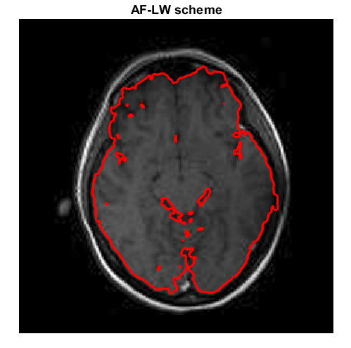 Figure 18