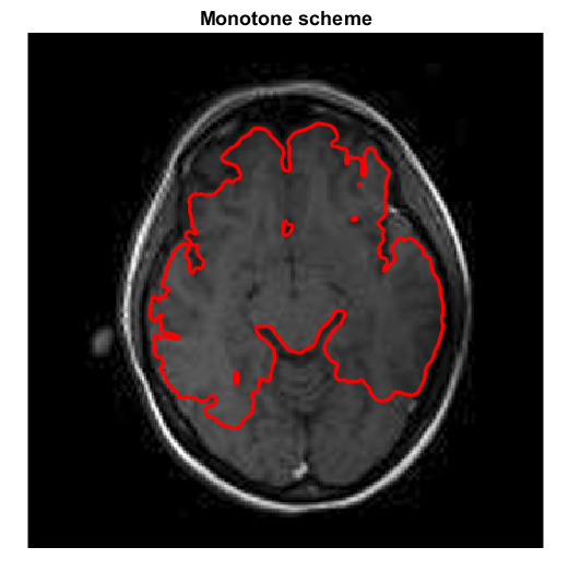Figure 22