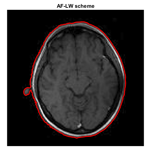 Figure 25