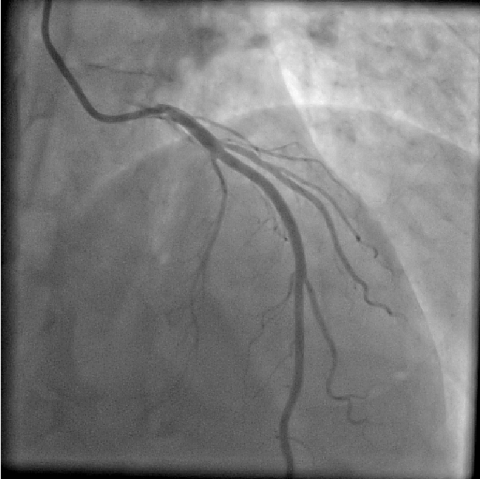 Figure 11