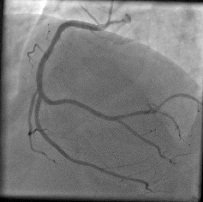 Figure 12