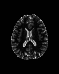Figure 14