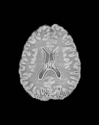 Figure 17
