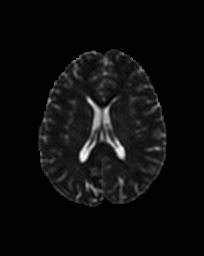 Figure 18
