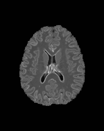 Figure 19