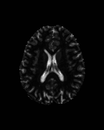 Figure 20