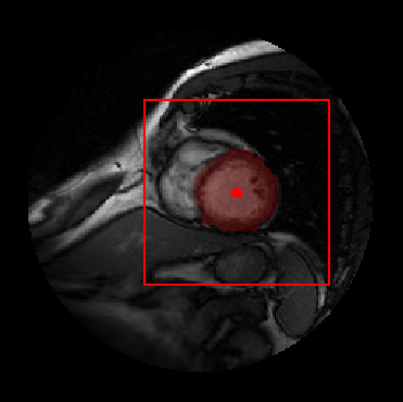 Figure 21