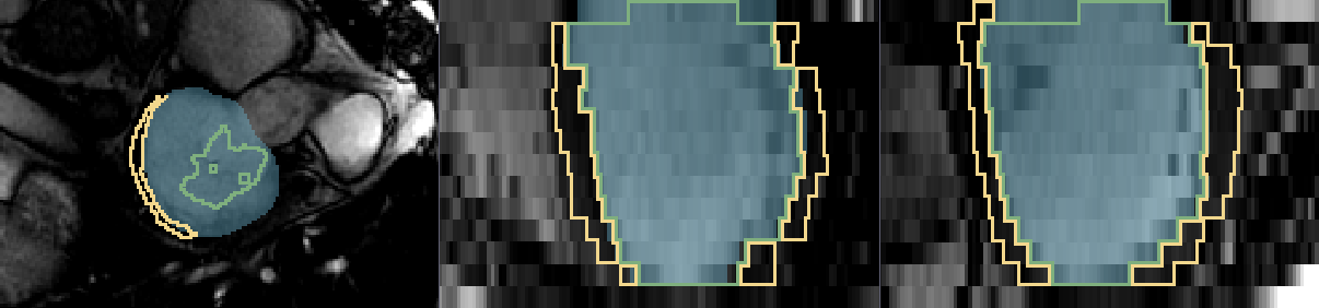 Figure 25