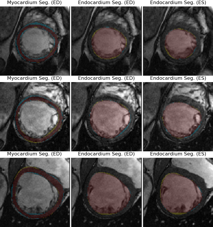 Figure 26