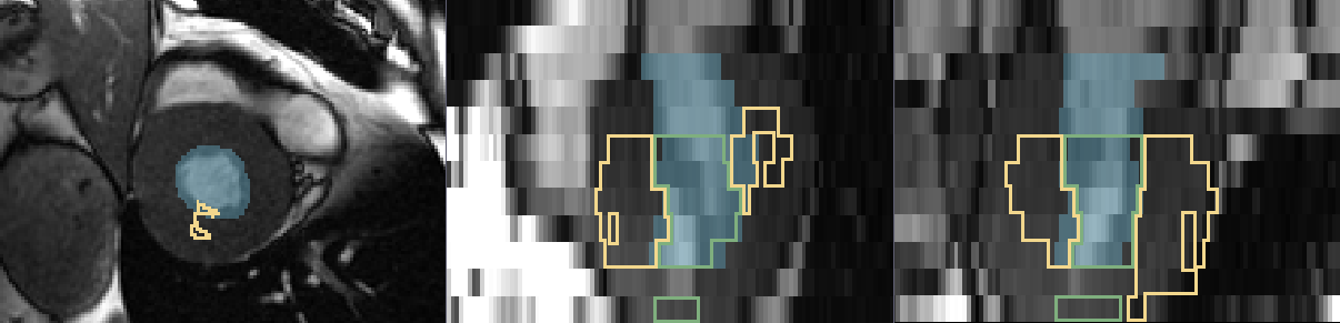 Figure 29