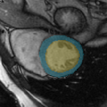 Figure 30