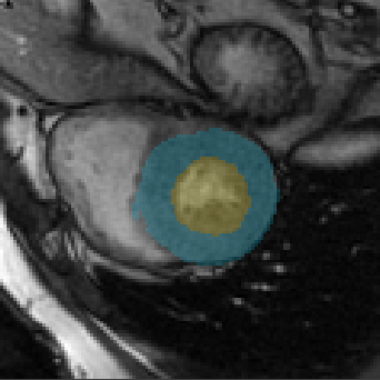 Figure 31