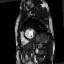 Figure 34