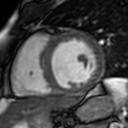 Figure 35