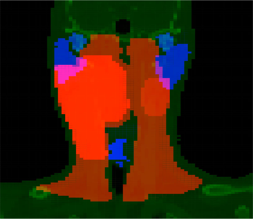 Figure 22