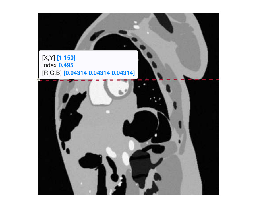 Figure 15