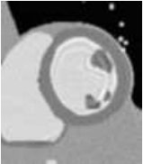 Figure 30