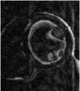 Figure 34