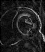 Figure 35
