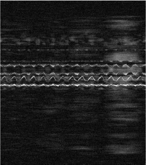 Figure 39