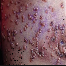 Figure 18