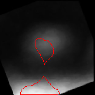 Figure 22
