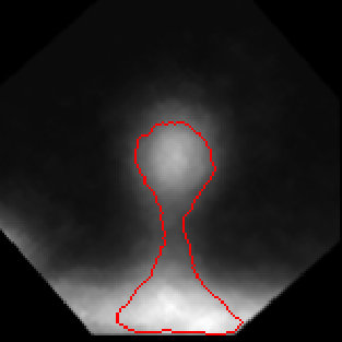 Figure 23