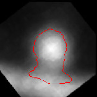 Figure 24