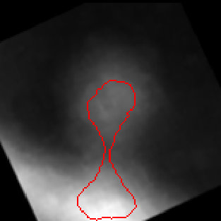 Figure 25