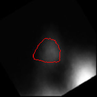 Figure 26