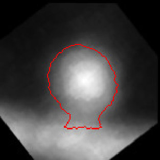 Figure 30