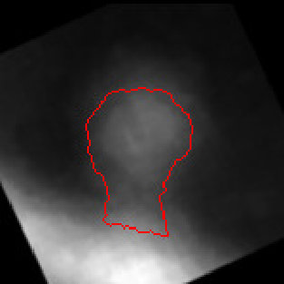Figure 31