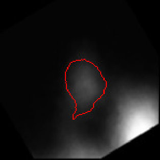 Figure 32