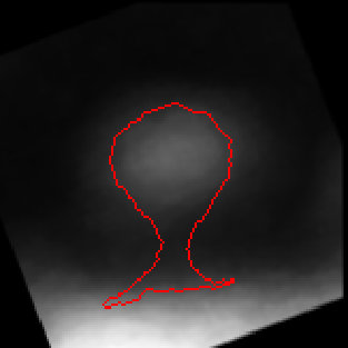 Figure 33