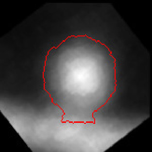 Figure 35