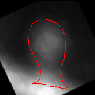 Figure 36