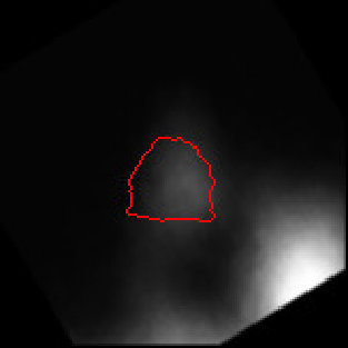 Figure 37