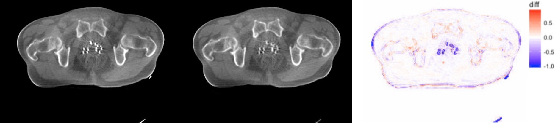 Figure 15
