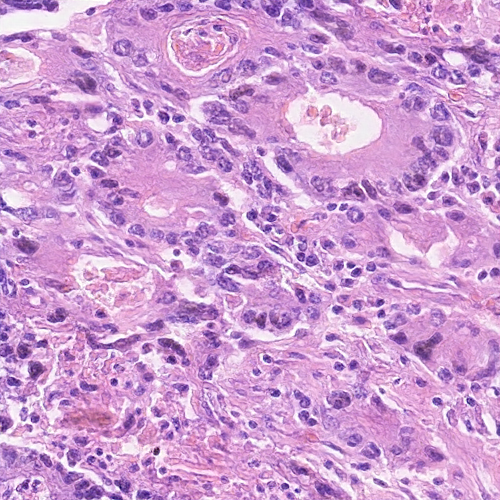 Figure 20